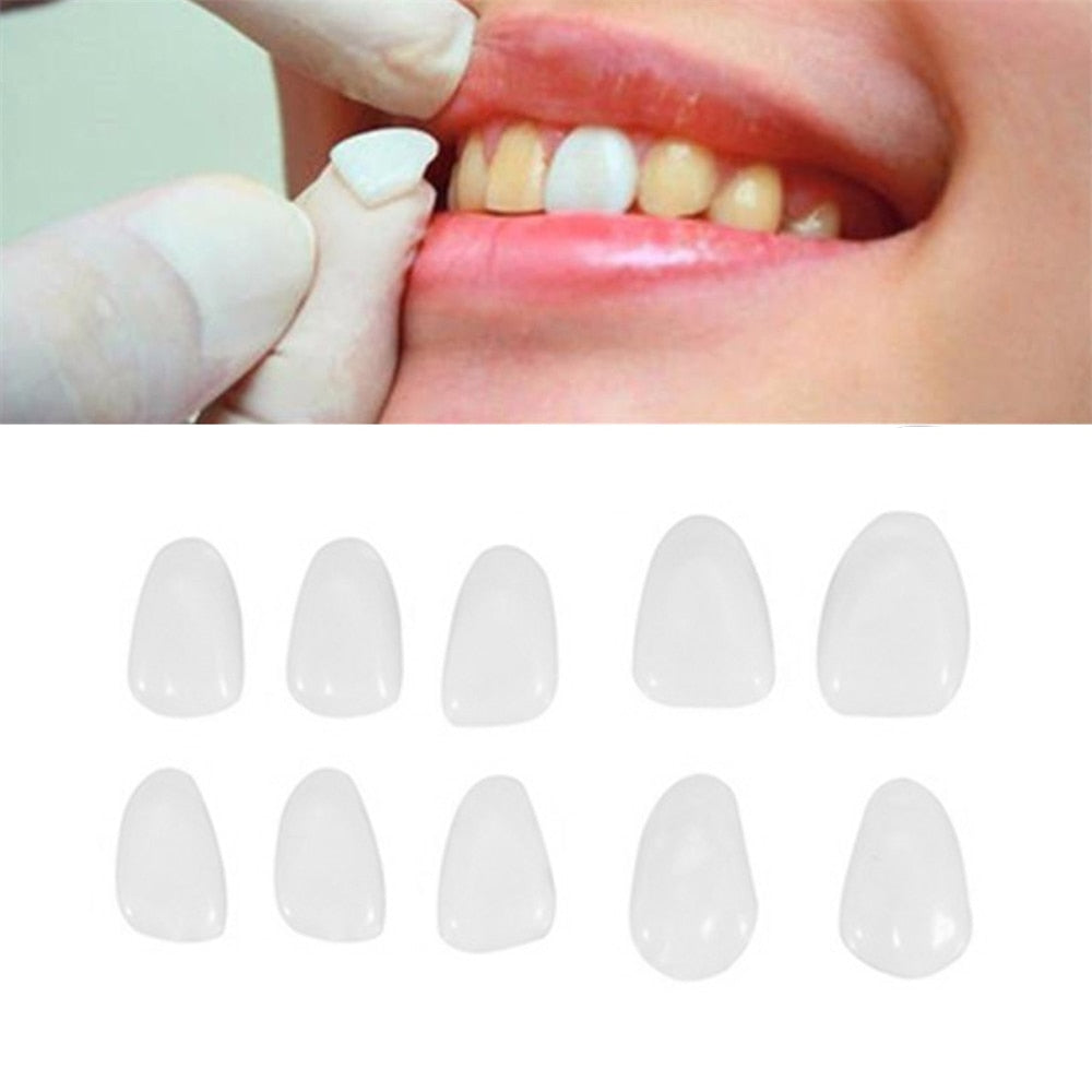 8g Facetas de clareamento dental ultrafinas Materiais de porcelana de resina Dentes temporários Película dental de clareamento anterossuperior Cuidados bucais